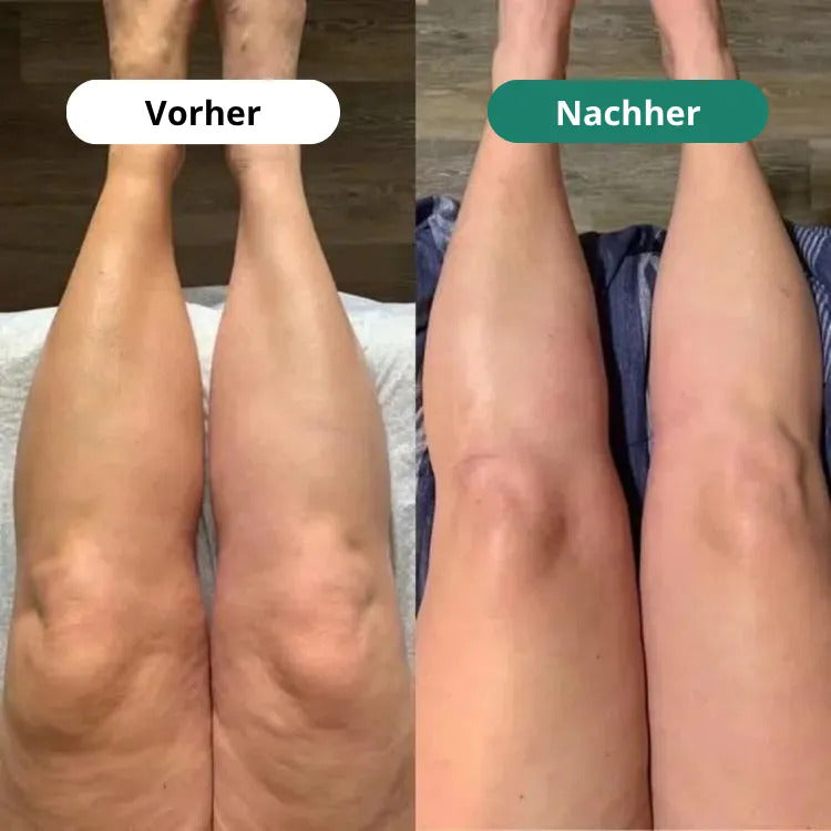 Ergebnis vorher/nachher