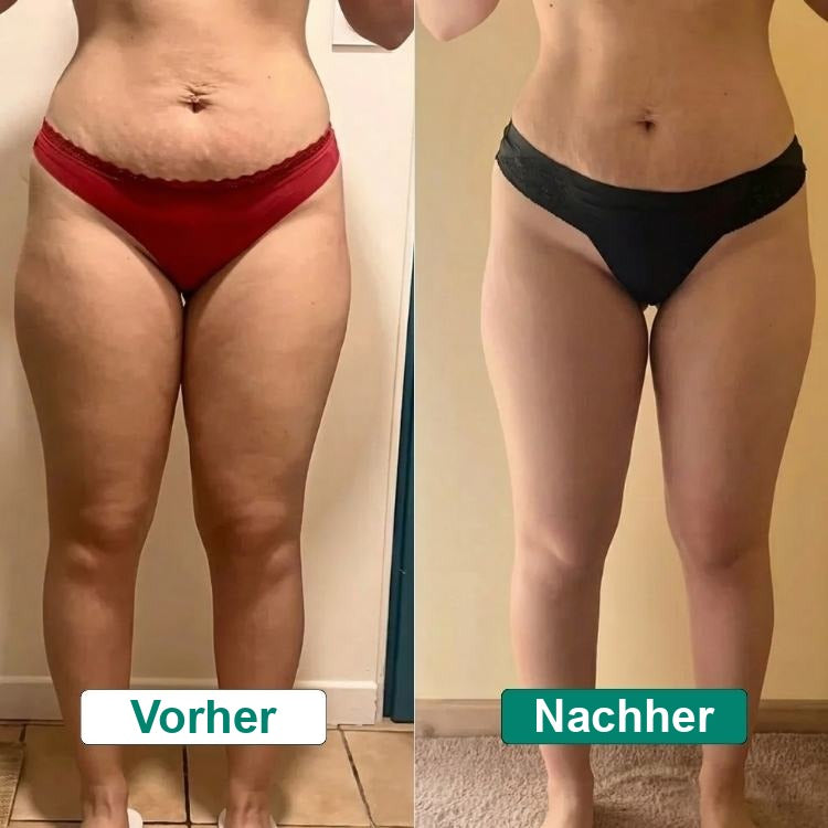 Ergebnis vorher/nachher